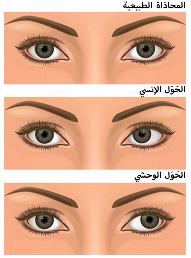 Iانواع الحول